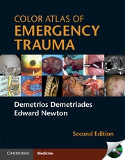 Color atlas of Emergency 2nd Edition