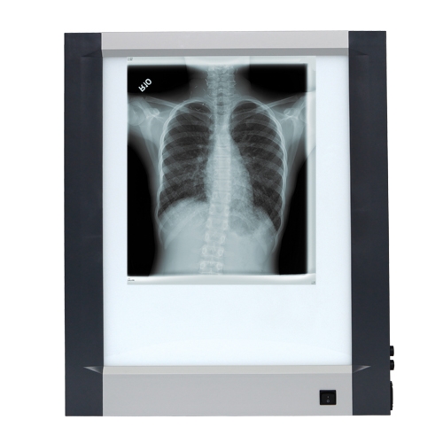 X- Ray Viewer, 1pce